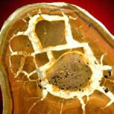 Septarian Nodule